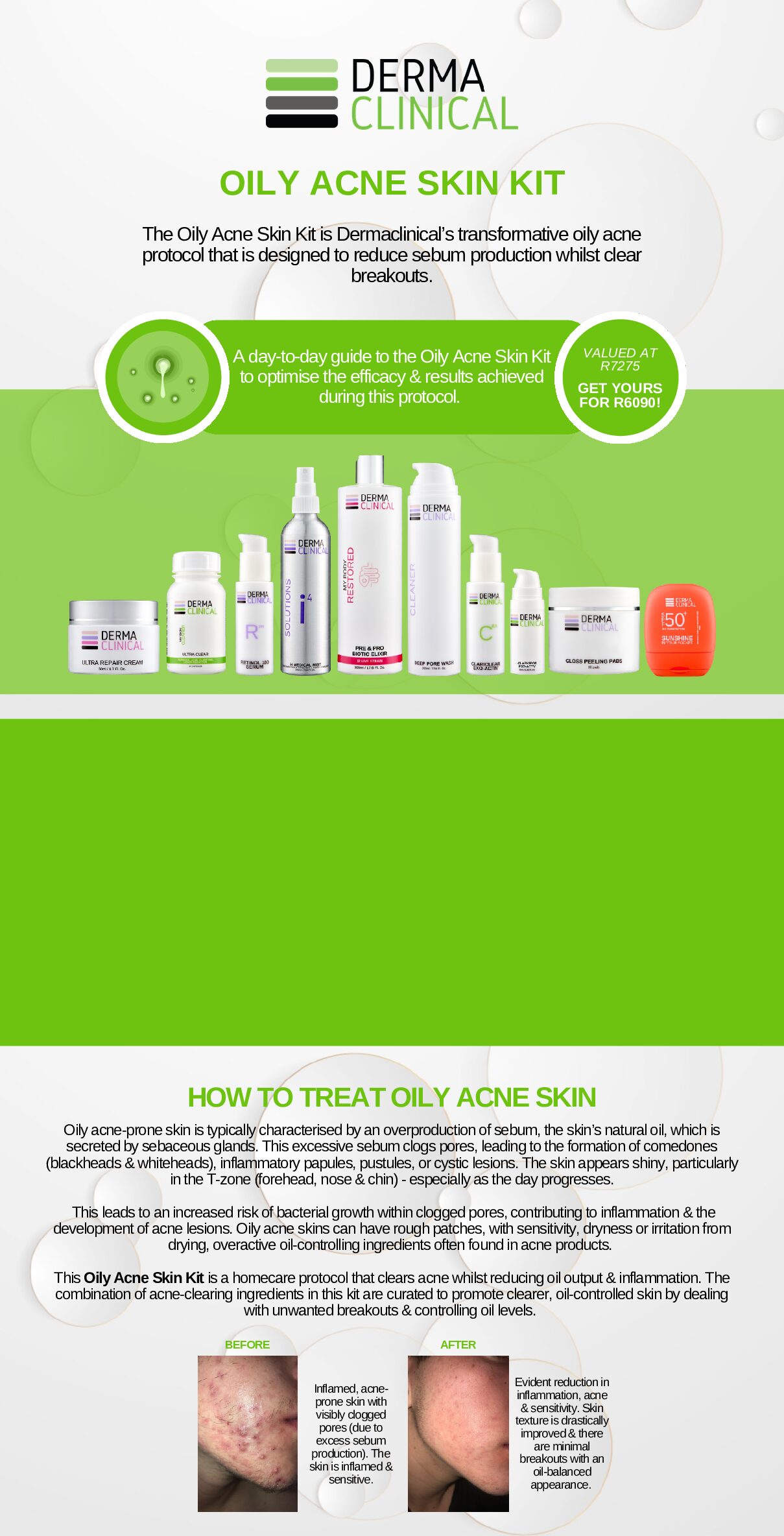 OILY ACNE SKIN PACK - Image 4